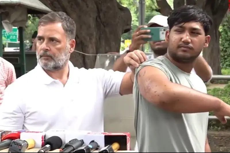 Delhi News: NEET विवाद पर राहुल गांधी का हमला… बोले- धर्मेंद्र प्रधान को जाना होगा