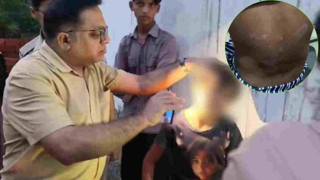 Shahdol News: शहडोल में 7 साल की बच्ची से प्रताड़ना का आरोप… घर से भागकर मांगी मदद